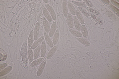 Pseudomassaria chondrospora