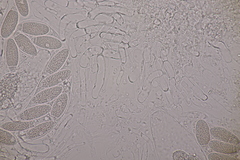 Pseudomassaria chondrospora