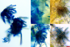 Pseudocercospora atromarginalis