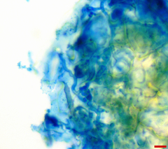 Pseudocercospora atromarginalis