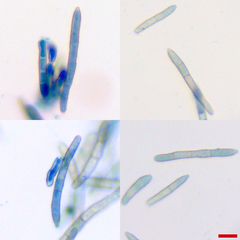 Pseudocercospora atromarginalis