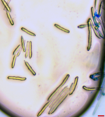 Pseudocercospora atromarginalis