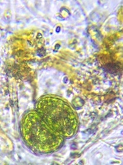 Cosmarium contractum