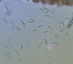 Hymenoscyphus scutula