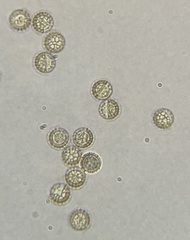 Reticularia splendens