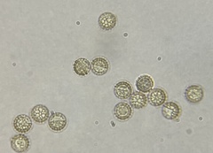 Reticularia splendens