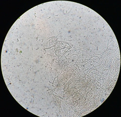 Dacrymyces corticioides