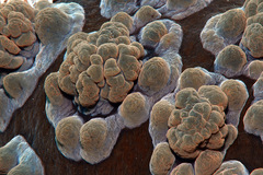 Dendrodoris carbunculosa