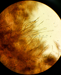 Ionomidotis irregularis