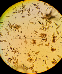 Ionomidotis irregularis