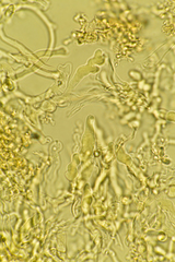 Corticium lombardiae