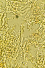 Corticium lombardiae