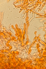 Corticium lombardiae