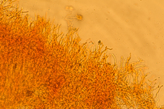 Corticium lombardiae