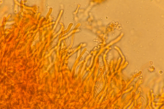 Corticium lombardiae