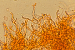 Corticium lombardiae