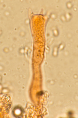 Corticium lombardiae