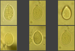 Corticium lombardiae