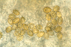 Gautieria morchelliformis