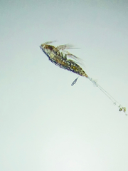 Microsetella norvegica