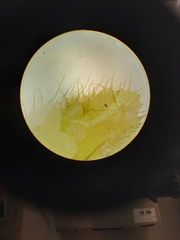 Schistochila ciliata