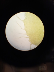 Schistochila ciliata