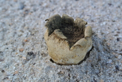 Scleroderma