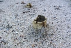 Scleroderma