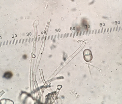 Trichothecium roseum