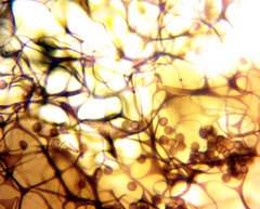 Diderma evelinae