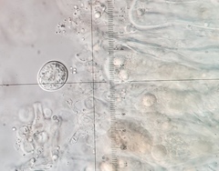 Aleurodiscus amorphus