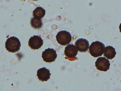 Scleroderma cepa