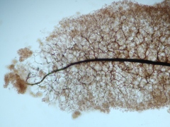 Stemonitopsis hyperopta