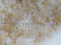 Stemonitopsis hyperopta