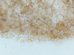 Stemonitopsis hyperopta