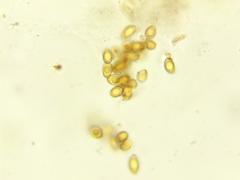 Clavariadelphus subfastigiatus