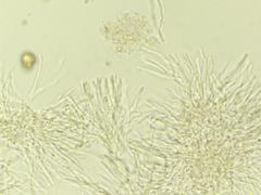 Clavariadelphus subfastigiatus