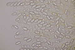 Sowerbyella radiculata