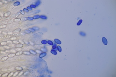 Sowerbyella radiculata