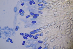 Sowerbyella radiculata