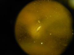 Macrostomum