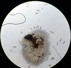 Bactridium ellisii