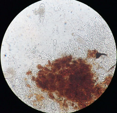 Bactridium ellisii