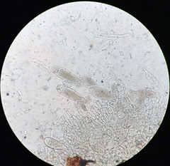 Bactridium ellisii
