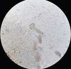 Bactridium ellisii