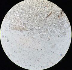 Bactridium ellisii