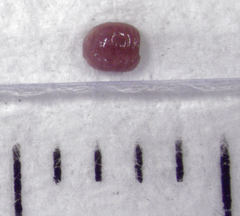 Eriococcus pohutukawa