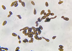 Alternaria