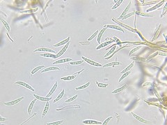 Fusarium