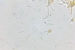 Fusarium